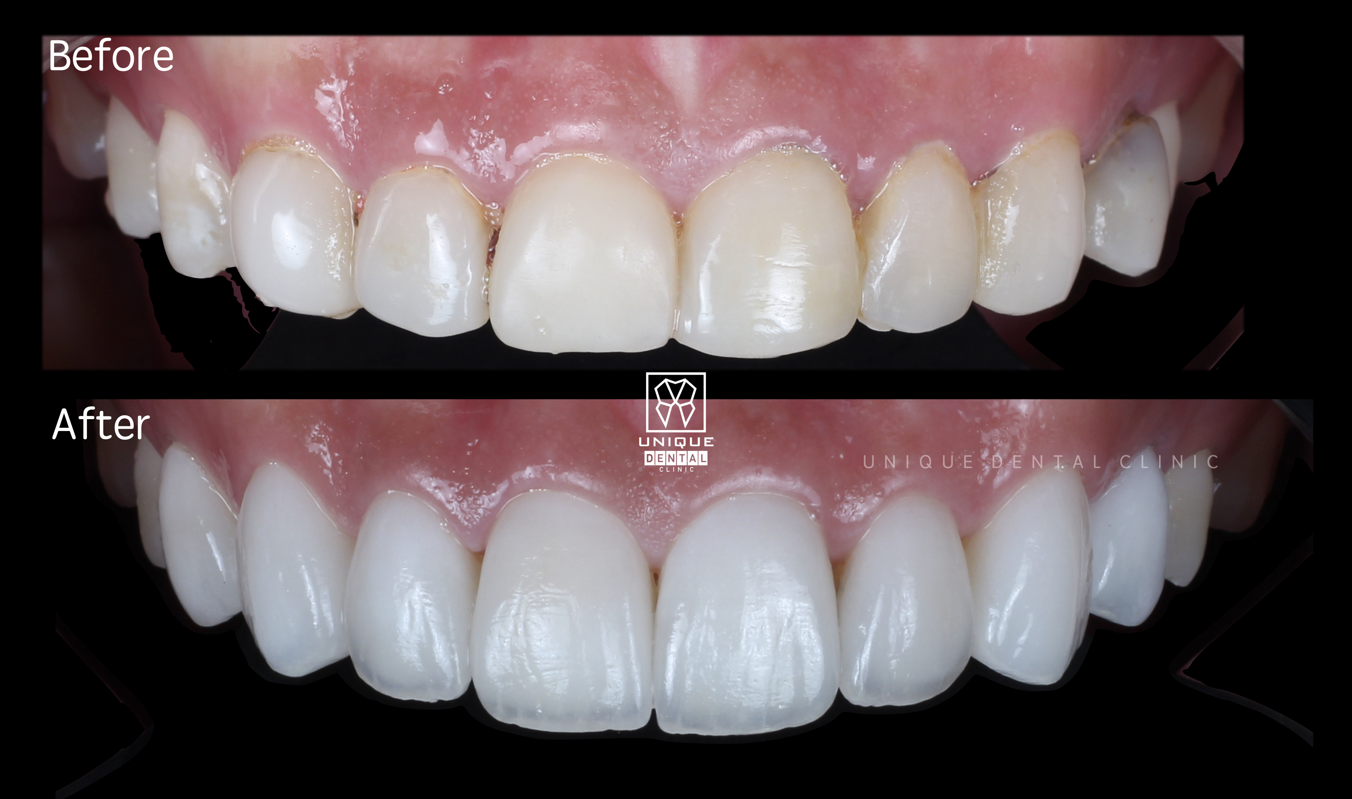 case image